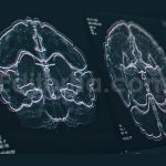 brain scan screen animation the device scans and d