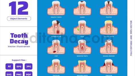 Decay Tooth - Dentist Dental Human Tooth Anatomy