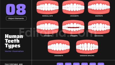 Human Malocclusion Teeth - Treatment Bite Care