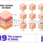 Human Skin Layers and Conditions Isometric View