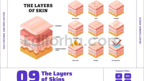Human Skin Layers and Conditions Isometric View
